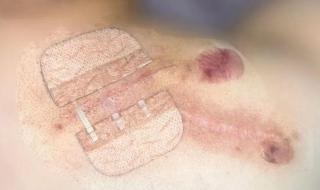 浙江癌症村 浙江癌症村